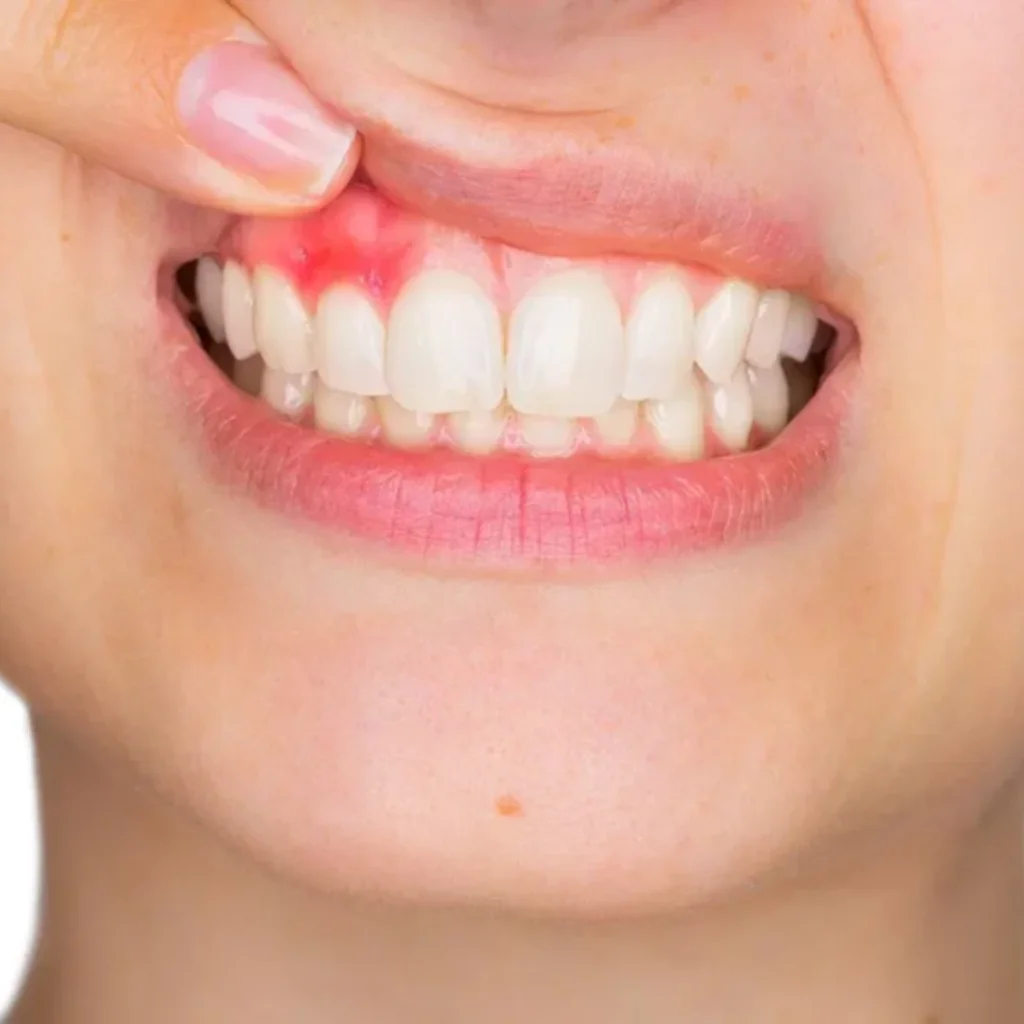 Dental & Gum Care